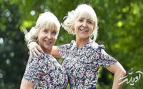 عجیبترین و مضحکترین جراحیهای زیبایی